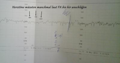 Bild zu herztöne sollen nicht toll sein- brauche eure meinug =( - Forum für April - Mamis