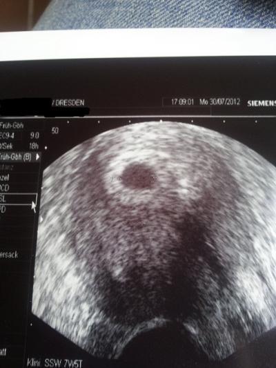 Bild zu Erstes Bildchen fürs Familienfotoalbum - Forum für April - Mamis