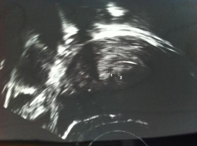 Bild zu Schwangerschaft bestätigt :) - Forum für April - Mamis