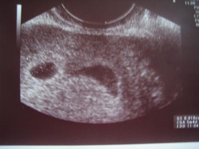Bild zu Heute zweiter FA-Termin... - Forum für April - Mamis