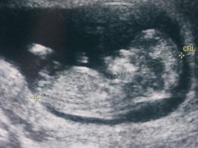 Bild zu Kritische Zeit geschaft - Forum für April - Mamis