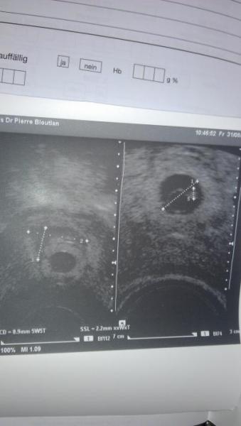 Bild zu Bericht fa - Forum für April - Mamis