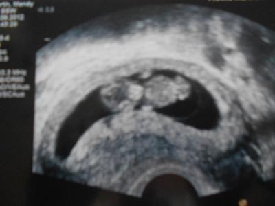 Bild zu Nochmaliger Versuch mit dem Bildchen! - Forum für April - Mamis
