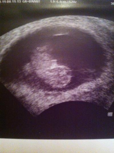Bild zu Unser Kleines - Forum für April - Mamis