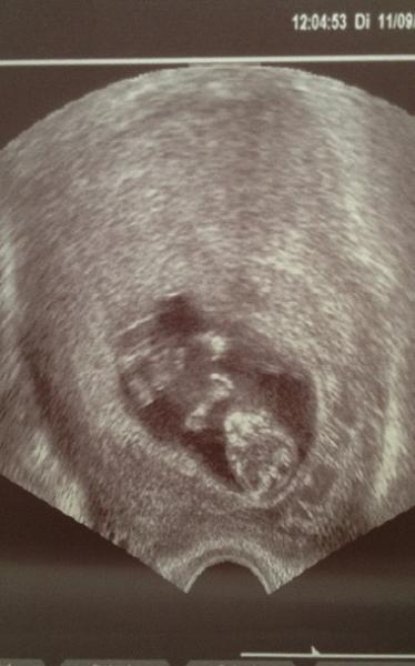 Bild zu Bild - Forum für April - Mamis
