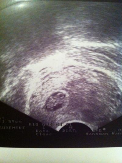 Bild zu bin wieder da vom Kh!!!! - Forum für April - Mamis