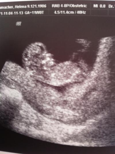 Bild zu US Bildchen - Forum für April - Mamis