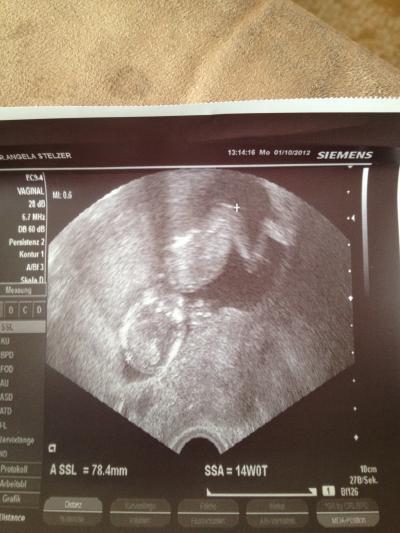 Bild zu Unser heutiges Foto :-) - Forum für April - Mamis