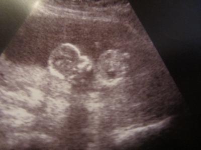 Bild zu FA-Bericht - Forum für April - Mamis