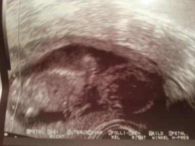 Bild zu Fa Termin - Forum für April - Mamis