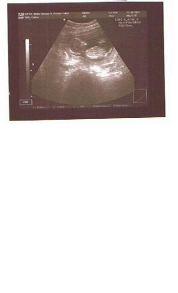 Bild zu Zurück von FÄ-Termin... - Forum für April - Mamis