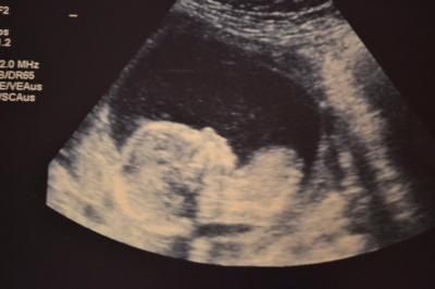Bild zu Mein Babylein...:-) - Forum für April - Mamis