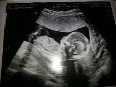 Bild zu wir bekommen ..... - Forum für April - Mamis