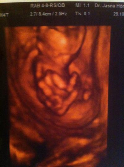 Bild zu das heutige 3D bild - Forum für April - Mamis