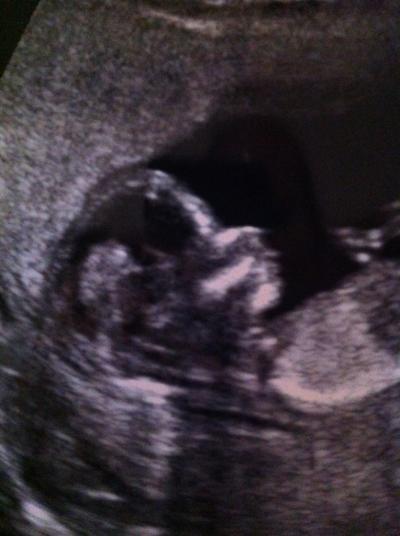 Bild zu noch 2 us fotos von gestern - Forum für April - Mamis