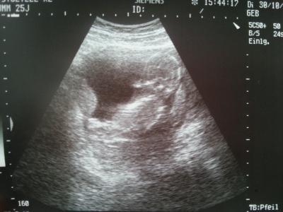 Bild zu Arzttermin und gedrückte Stimmung. ... - Forum für April - Mamis