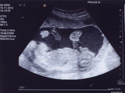 Bild zu Outingbild! Wer kanns erkennen..... ;-) - Forum für April - Mamis