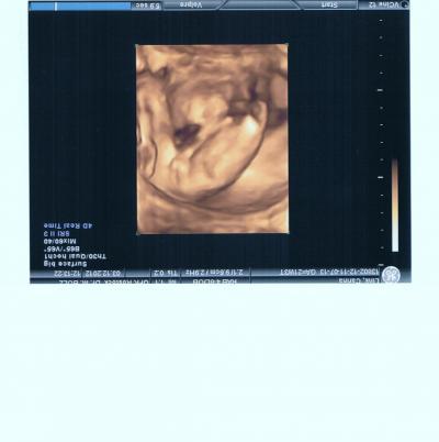 Bild zu Hebammentermin zu Hause... - Forum für April - Mamis