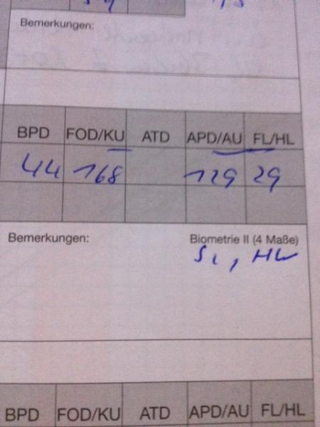 Bild zu 