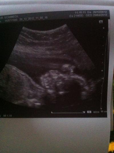 Bild zu Hihi - Forum für April - Mamis