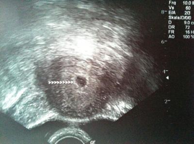 Bild zu Zurück vom 1.FA - Forum für April - Mamis