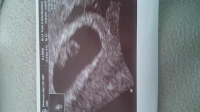 Bild zu Zurück vom FA! - Forum für April - Mamis