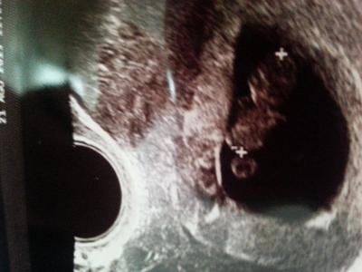 Bild zu bildchen - Forum für April - Mamis