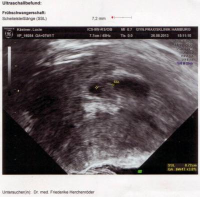 Bild zu Mein Krümel - Forum für April - Mamis