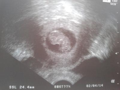 Bild zu zurueck vom FA...mit Bild - Forum für April - Mamis