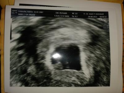 Bild zu fa termin - Forum für April - Mamis