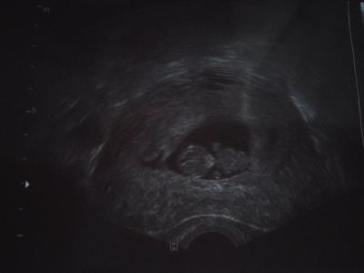 Bild zu ENDLICH! FA-Termin - Forum für April - Mamis