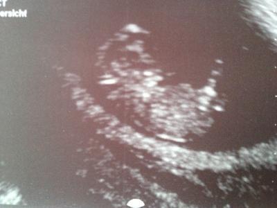 Bild zu Zurück von der FÄ - Forum für April - Mamis