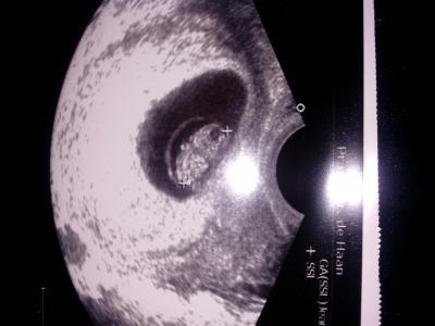 Bild zu Mein Bauchbewohner. ... - Forum für April - Mamis