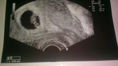 Bild zu FA-termin heute - Forum für April - Mamis