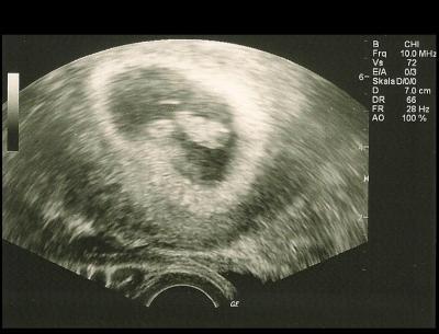 Bild zu FA-Termin heute + US-Foto - Forum für April - Mamis