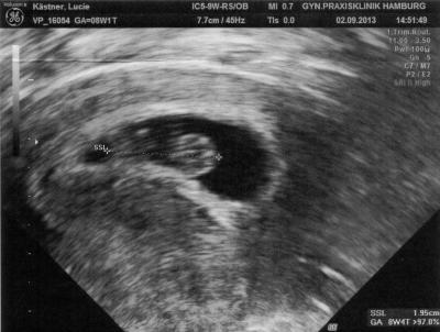 Bild zu Feedback zum Arzttermin - Forum für April - Mamis