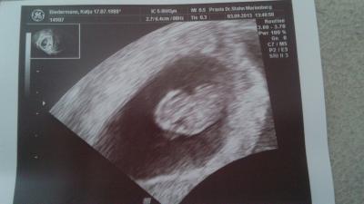 Bild zu Zurück vom FA! - Forum für April - Mamis