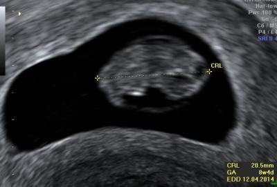 Bild zu Wow.. - Forum für April - Mamis