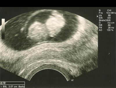 Bild zu US-Termin heute - Forum für April - Mamis