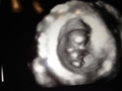 Bild zu Hier noch meine Bilder. Das 3D erkennt man leider in abfotografierter Form... - Forum für April - Mamis