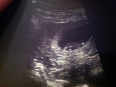 Bild zu 2.Termin beim FA - Forum für April - Mamis