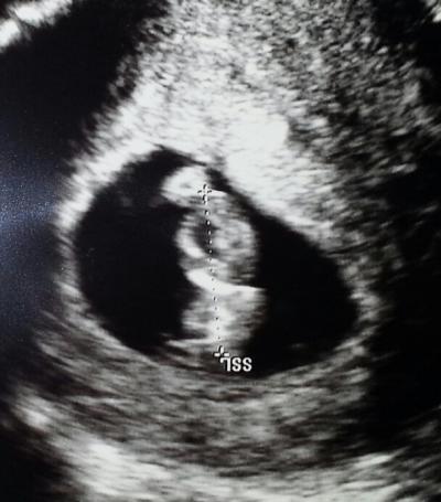 Bild zu zurück vom gyn - Forum für April - Mamis