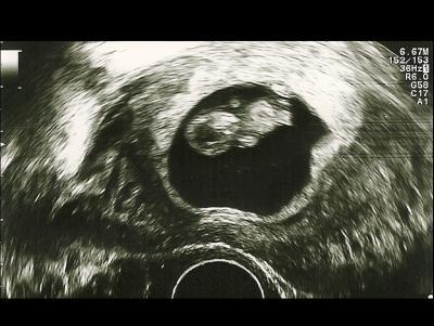 Bild zu War heute auch beim FA - Forum für April - Mamis