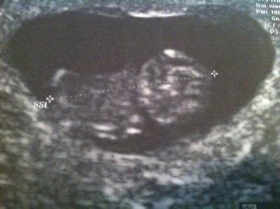 Bild zu Termin perfekt gelaufen :-) - Forum für April - Mamis