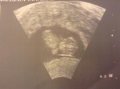 Bild zu Neu hier :) - Forum für April - Mamis