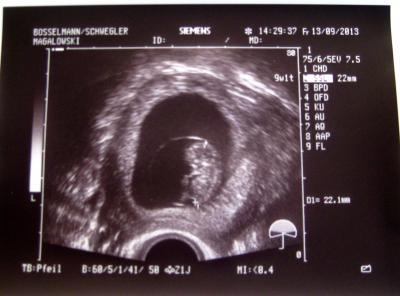 Bild zu Endlich ein Bild - Forum für April - Mamis