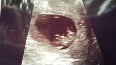 Bild zu Zurück vom FA - Forum für April - Mamis