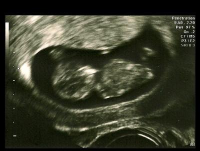 Bild zu War auch beim FA (schon gestern) - Forum für April - Mamis