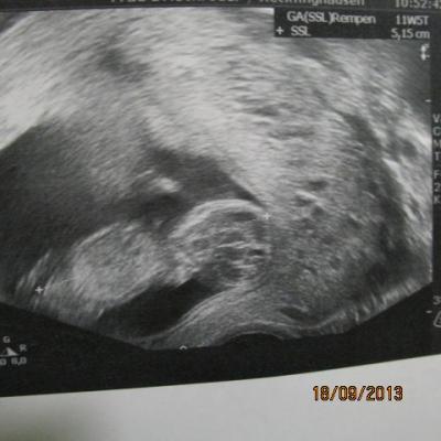 Bild zu Bericht von FÄ - Forum für April - Mamis