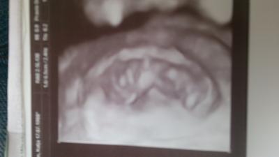 Bild zu auch beim FA :-) - Forum für April - Mamis